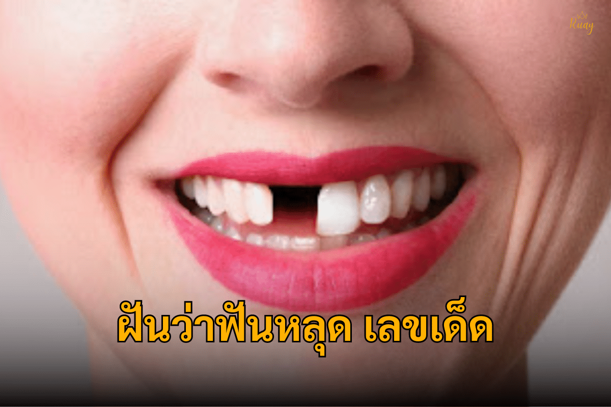 ฝันว่าฟันหลุดเลขเด็ด